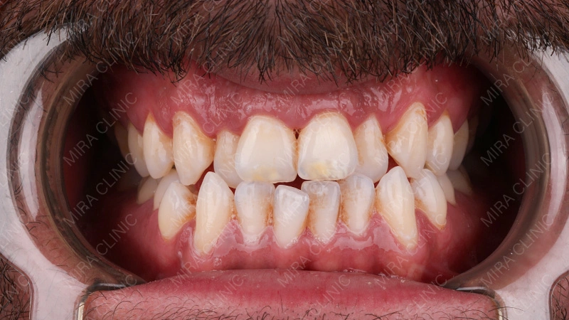 The Problem Before Treatment